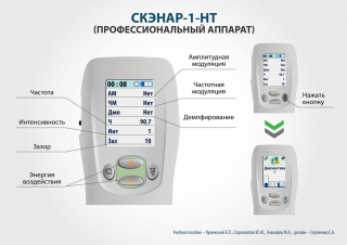 СКЭНАР-1-НТ (исполнение 01)  в Челябинске купить Нейродэнс ПКМ официальный сайт - denasdevice.ru 